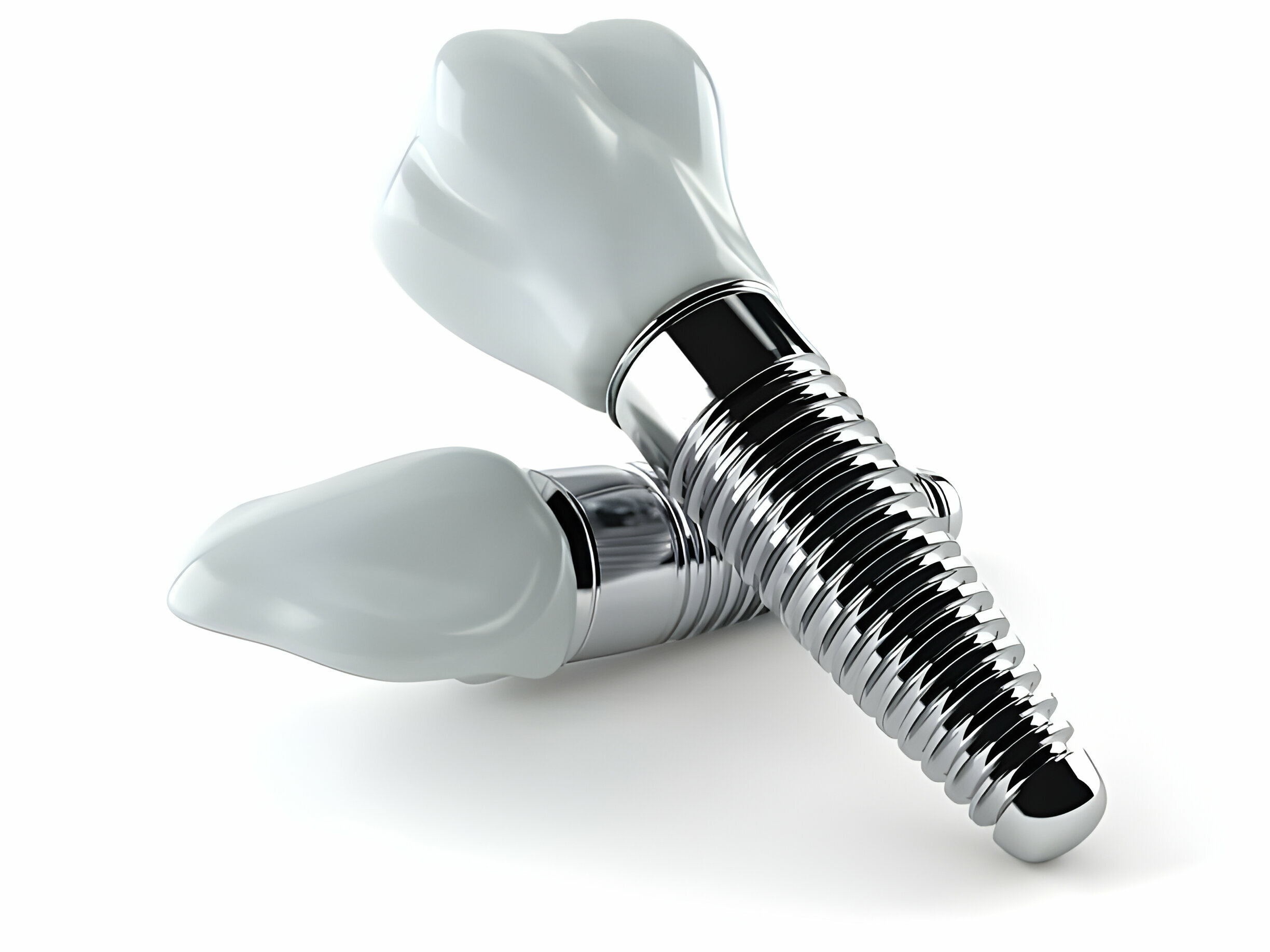 Discover Dental Implants in Aberdeen: A Complete Guide